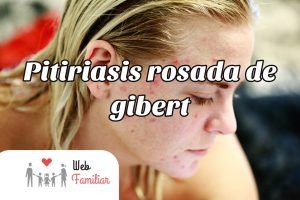 Lee más sobre el artículo 🔴 ¡Cura la Pitiriasis Rosada de Gibert con estos Remedios Naturales! 🌿