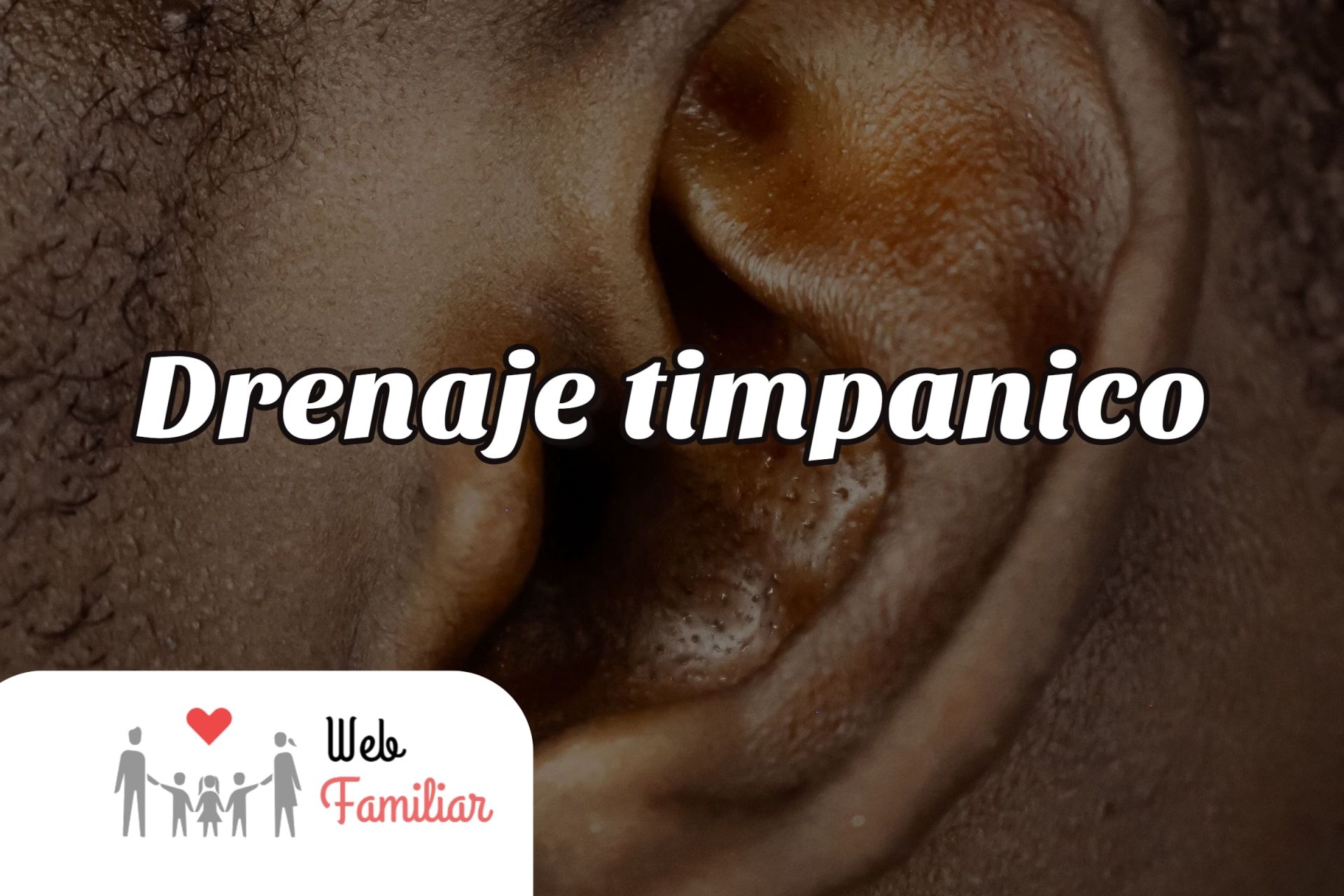 Lee más sobre el artículo 🔊 ¡Cura tu Otitis con Drenaje Timpánico! 💧