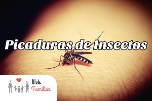 Lee más sobre el artículo ¡¡Cómo prevenir y tratar las 🐝 Picaduras de Insectos!!