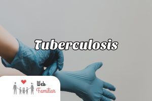 Lee más sobre el artículo 👩‍⚕️¡Cura la Tuberculosis con Estos Remedios Naturales!