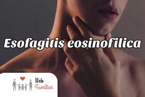 Lee más sobre el artículo 🤒 ¿Cómo tratar la esofagitis eosinofílica? Consejos para aliviar los síntomas
