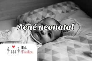 Lee más sobre el artículo 🤱¡Todo lo que necesitas saber sobre el Acné Neonatal!